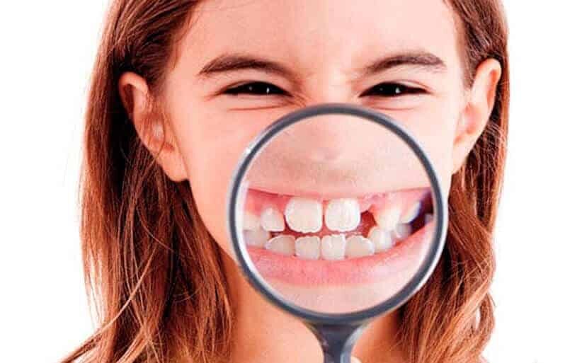 Microdoncia y macrodoncia Desarrollo dentario