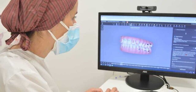 Acelerar tratamiento de ortodoncia Microperforaciones en ortodoncia