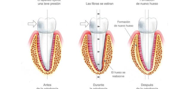 Movimientos dentales