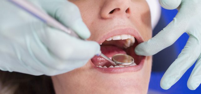 Qué son las microperforaciones en ortodoncia En qué consisten las microperforaciones en ortodoncia