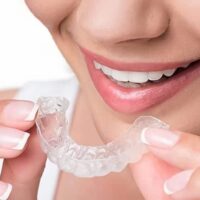 Sistema alineadores invisibles Invisalign