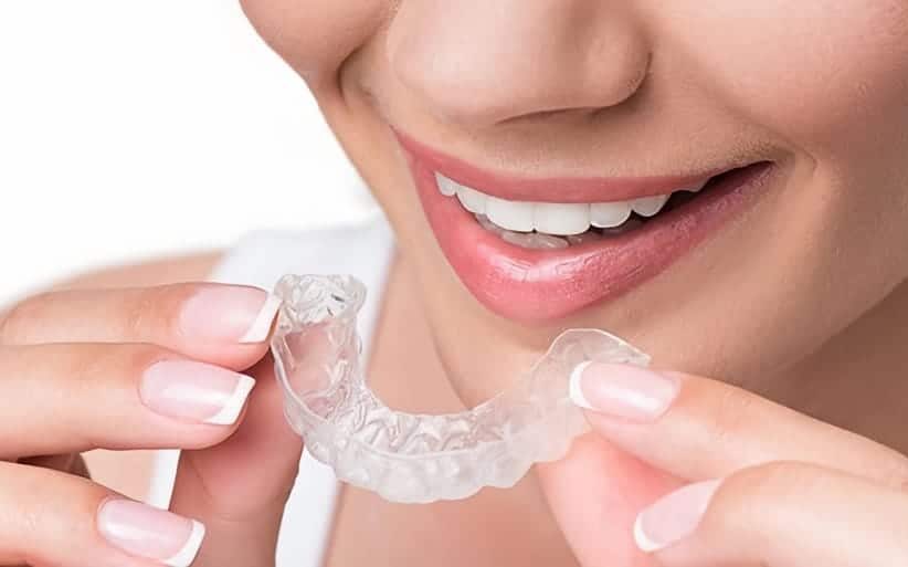 Alineadores invisibles Invisalign Sistema alineadores invisibles Invisalign