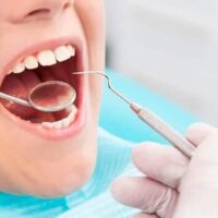 Tratamiento para las caries