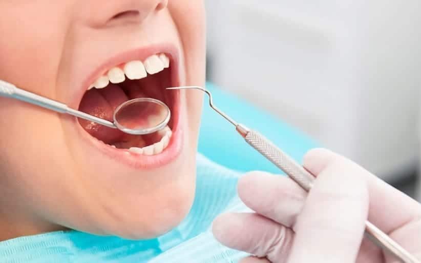 Cómo prevenir la caries infantil Tratamiento para las caries