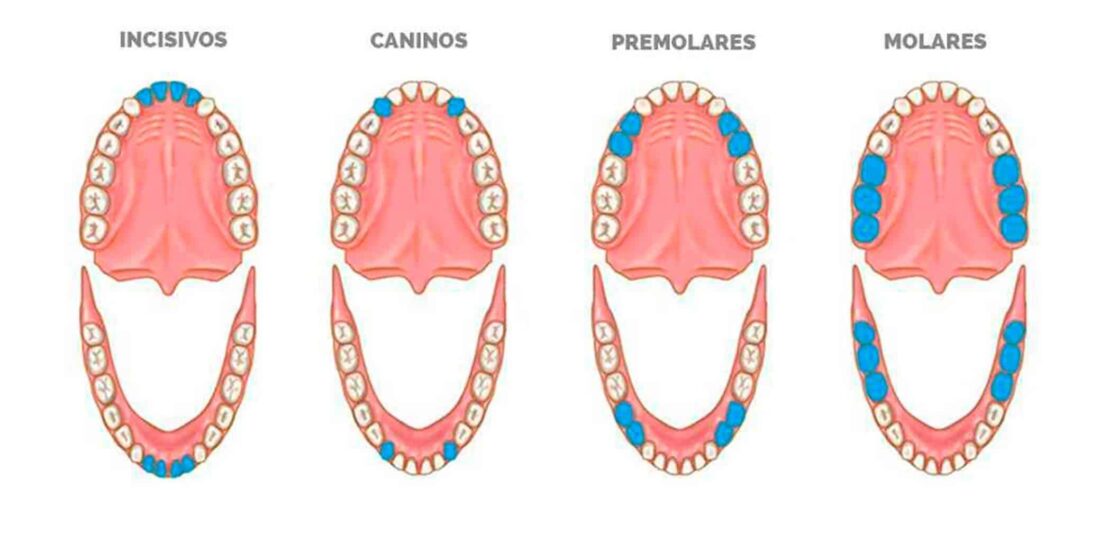 Nombres de los dientes: ¿cómo se llama cada uno? | Ferrus&Bratos
