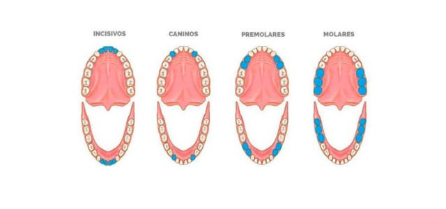 Nombres piezas dentales