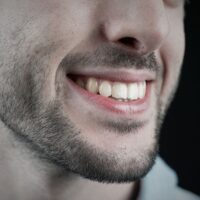 Conoce las opiniones de ortodoncia invisible de los pacientes reales de la Clínica Dental Ferrus & Bratos