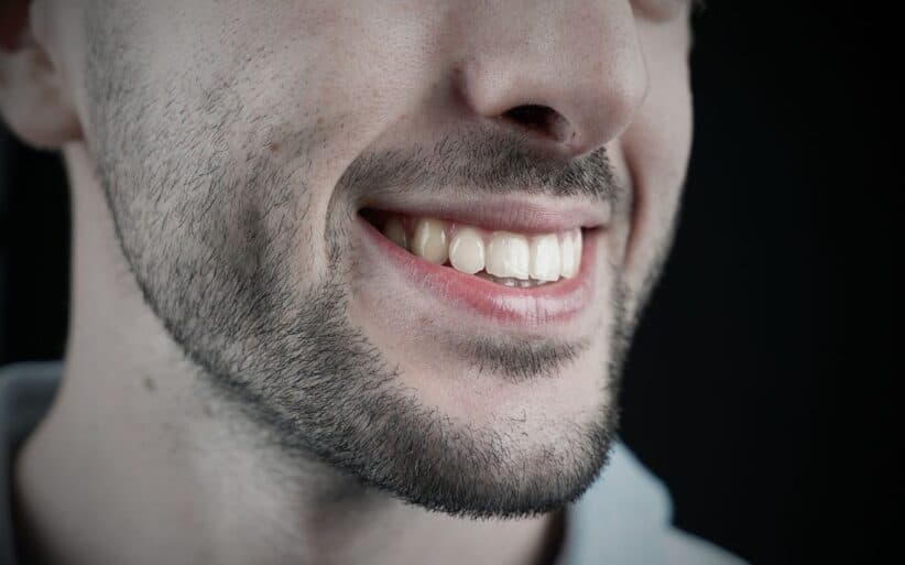 Paciente sonriendo tras compartir su opinión de ortodoncia invisible Conoce las opiniones de ortodoncia invisible de los pacientes reales de la Clínica Dental Ferrus & Bratos