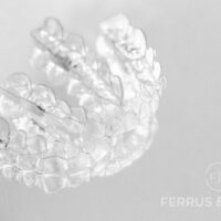 Opiniones pacientes reales de Invisalign