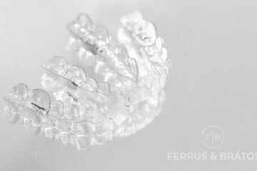 Opiniones pacientes reales de Invisalign