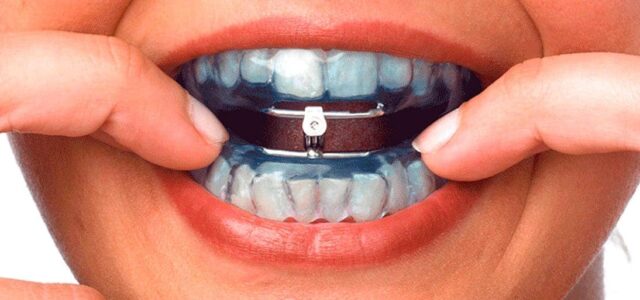 OrthoApnea qué es OrthoApnea precio