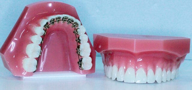 Brackets Incognito