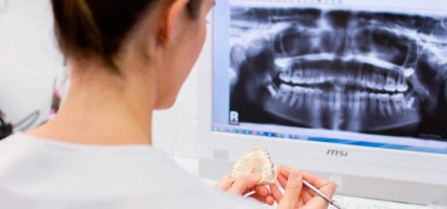 Radiografía Periodonto con ortodoncia