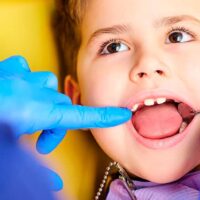 Ortodoncia infantil precio