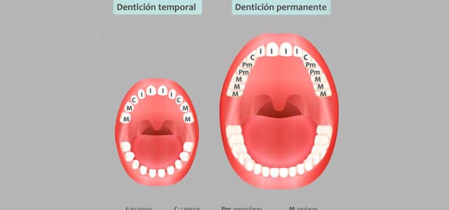 Dentición mixta