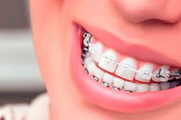 Brackets combinados