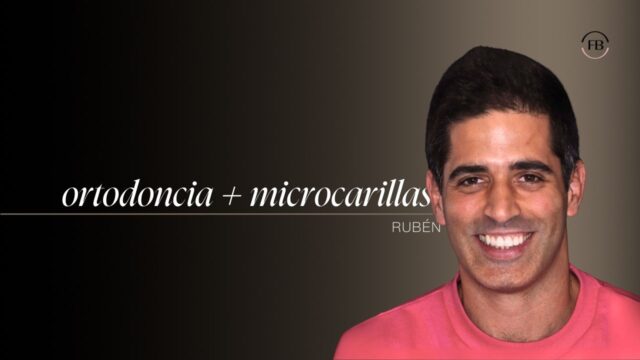 La sonrisa de Rubén