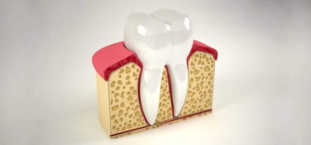 Estructura de una corona Corona dental