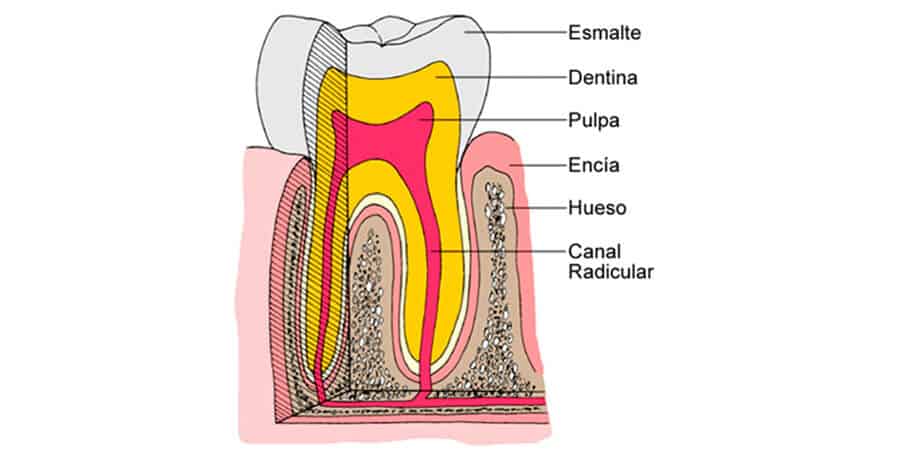 pulpitis sintomas y causas