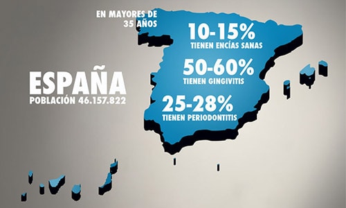 Piorrea: ¿cómo evitar sus consecuencias y curarla para siempre?