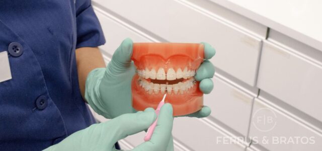 Cepillo interdental