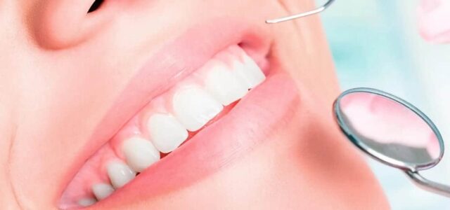 Placa dental Placa bacteriana