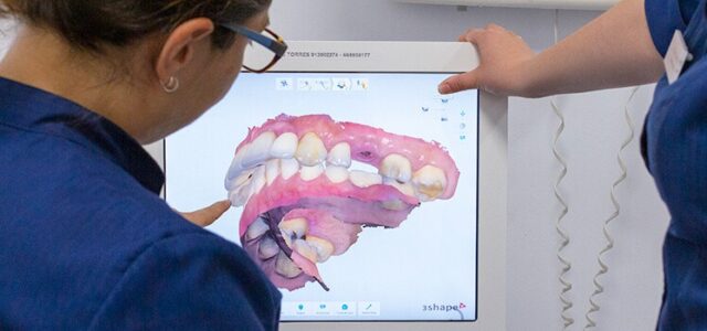 Implante dental precio ¿Cuánto cuesta un implante dental?