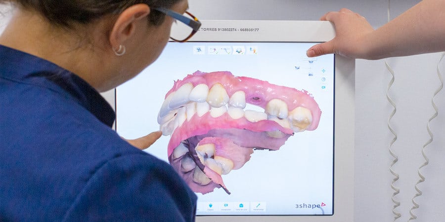 Cuanto cuesta una protesis dental removible