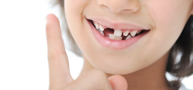 Preguntas frecuentes sobre los dientes de leche Cómo quitar un diente de leche sin dolor