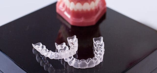 Preguntas y respuestas sobre Invisalign