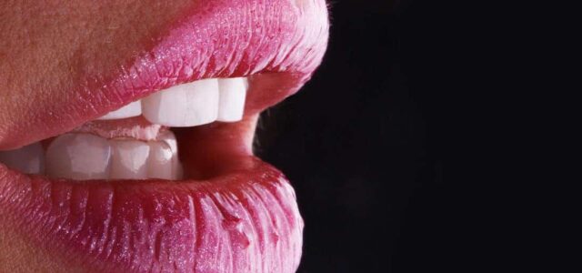 Problemas de las carillas dentales Cómo cuidar las carillas dentales