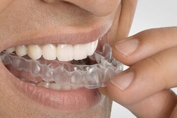 Puedo hablar con ortodoncia con Invisalign