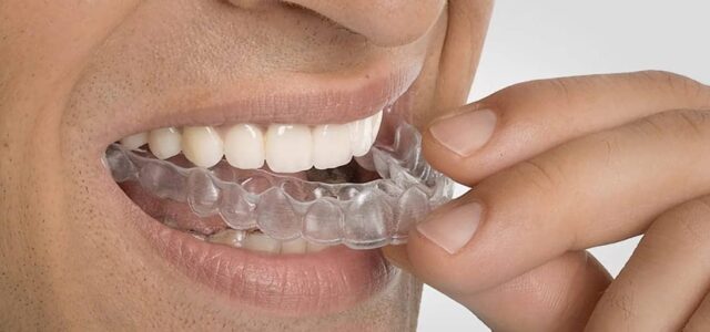 Problemas para hablar con Invisalign Puedo hablar con ortodoncia con Invisalign