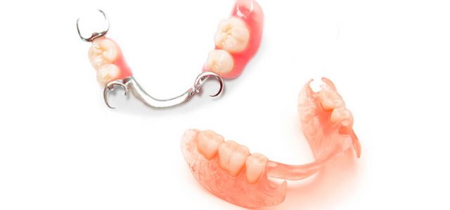 Sabes cómo tu prótesis dental removible? |