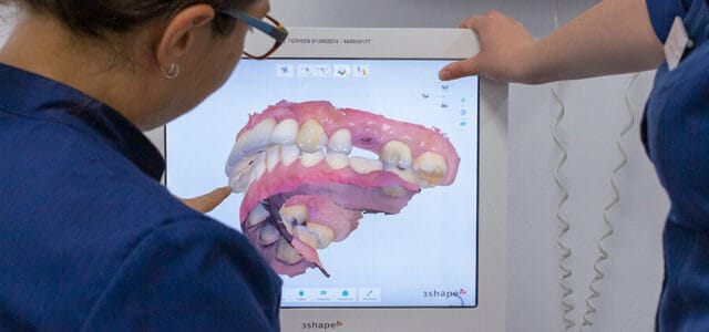 Implantes dentales