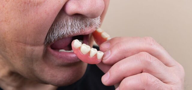 Prótesis flexible sin ganchos Dentadura removible sin ganchos