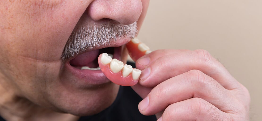 Tropical Contiene error Prótesis dentales: ¿cuántos tipos existen? | Ferrus&Bratos