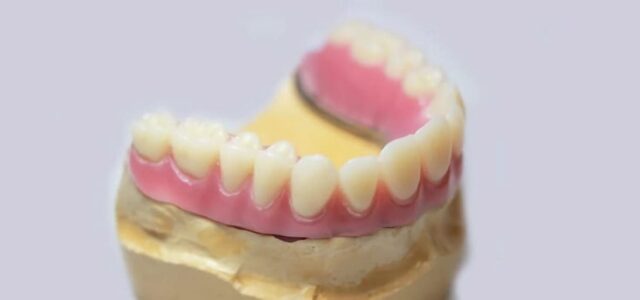 Tipos de prótesis dentales Trabajamos con todas las prótesis