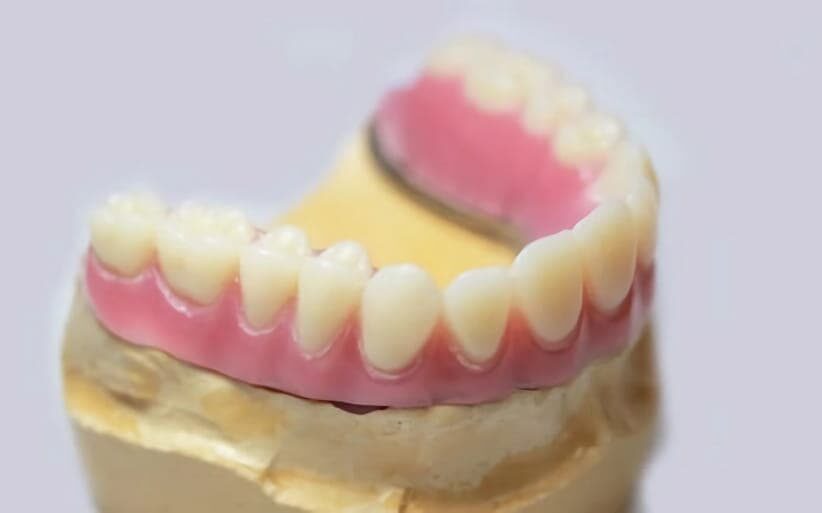Tipos de prótesis dentales Trabajamos con todas las prótesis