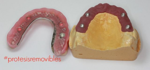 protesis removibles completas protesis removibles flexibles