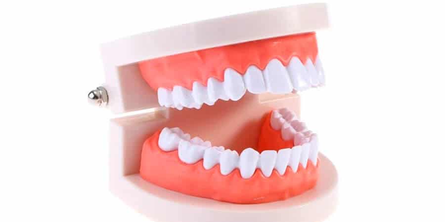 incisivos de agenesia dental inferior