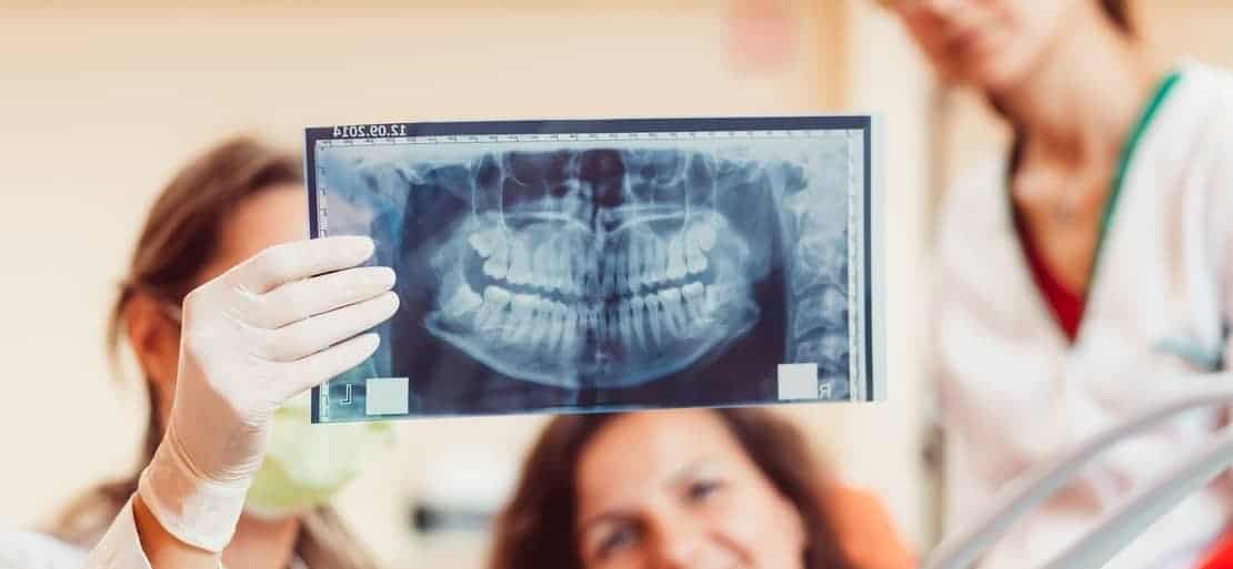 Radiografia de maxilar y mandibula