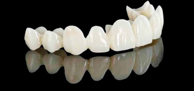 Cromático Estado tema Prótesis dental fija: todos los tipos que existen | Ferrus&Bratos
