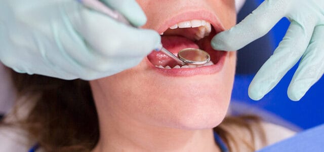 Revisión con Invisalign
