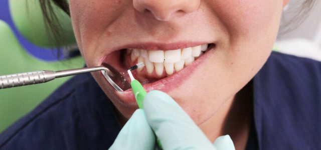 Haz revisiones periódicas en el dentista