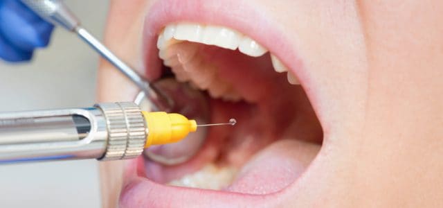 Cuándo se puede optar por la sedación en lugar de la anestesia dental