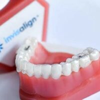 seguros dentales invisalign