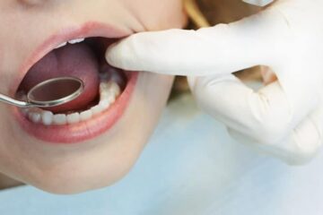 Sellado dental