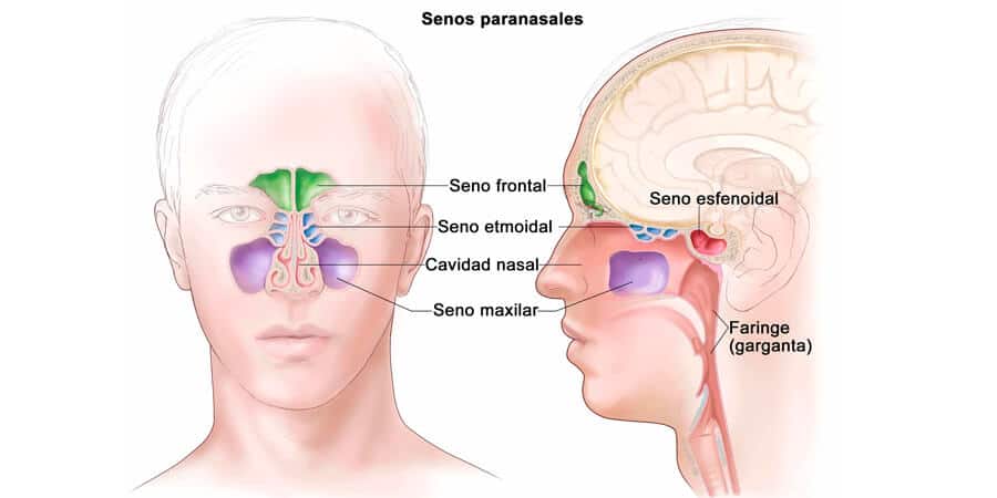 sinusitis aguda y cronica