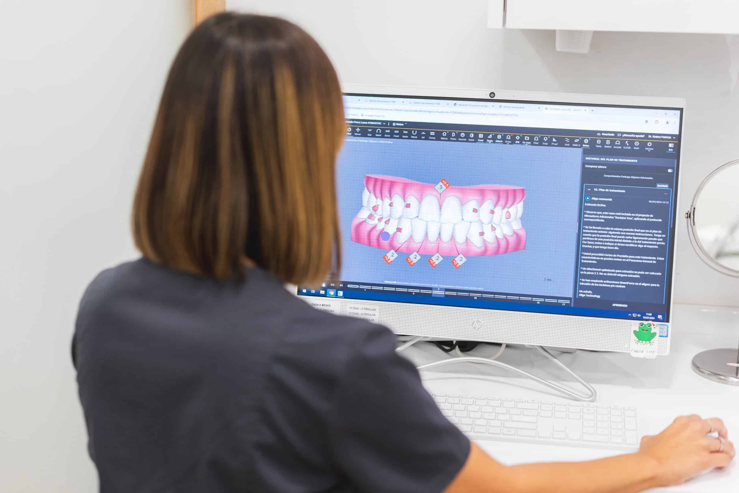 Cirujana enseñando caso de implantes con poco hueso